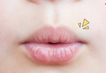 Cara Efektif Atasi Bibir Kering dan Pecah-Pecah