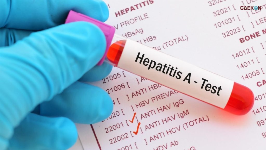 Fakta Tentang Hepatitis, Terdengar “Biasa” Tapi Bisa “Berbahaya”!