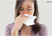 Sebelum Meradang: Ini 5 Cara Mencegah Penyakit Polip Hidung!