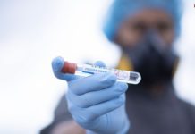 Bila Memang Harus Berdamai, Kenapa Tidak dari Sekarang?