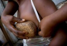 Bahaya, Praktik Setrika Payudara Masih Kerap Dilakukan, Ini Kata Praktisi!