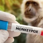 Cacar Monyet Kembali Ditemukan, Kenali Cara Penularannya cacar monyet